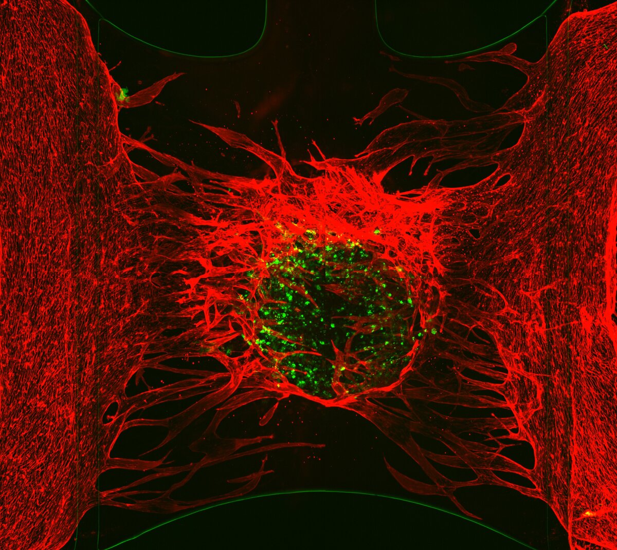 In Vitro Grafting Of Hepatic Spheroids And Organoids On A Microfluidic Vascular Bed