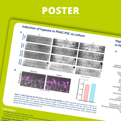 Poster Development of a 3D microphysiological placenta barrier in vitro model as a tool for drug transport studies